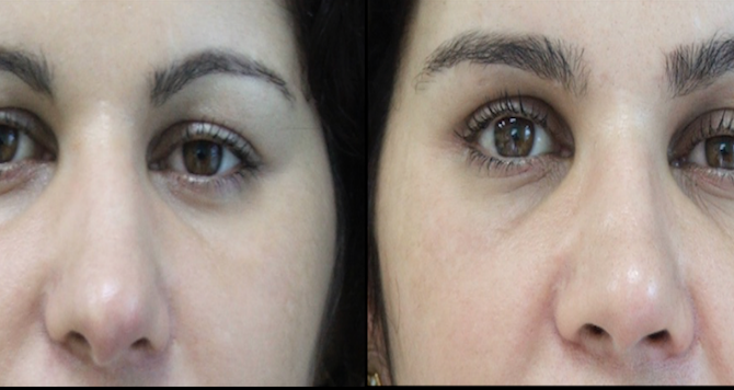 Os olhos iluminados