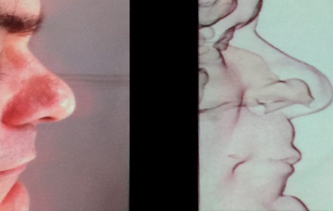 Rinoplastia e pele